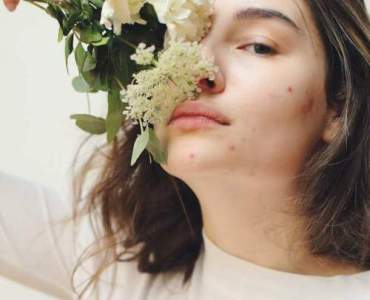 Hormony a trądzik: przyczyny, objawy i sprawdzone sposoby leczenia